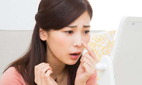 鼻を気にする女性
