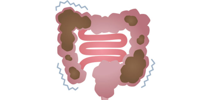 便秘