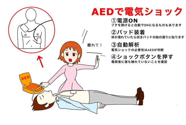 AEDで電気ショック