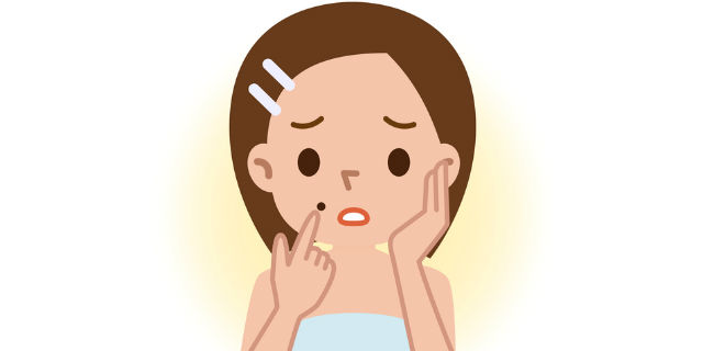 顔にほくろができた女性