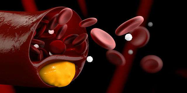 コレステロールや赤血球