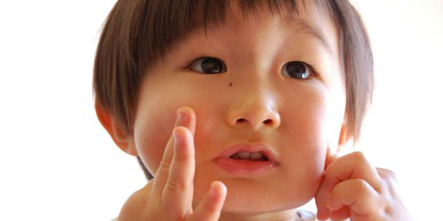 子どもの皮膚