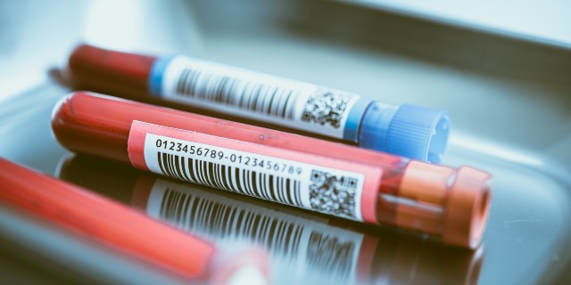 新型コロナの診療方針改訂!軽症者も注意の「血栓症」とは?