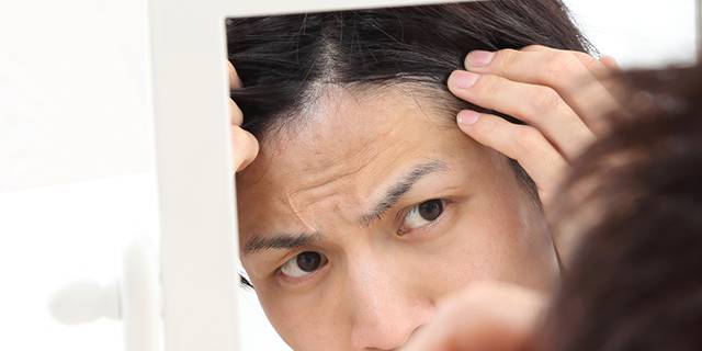 【これってストレス？それとも…】脱毛症、7つの種類と特徴とは？