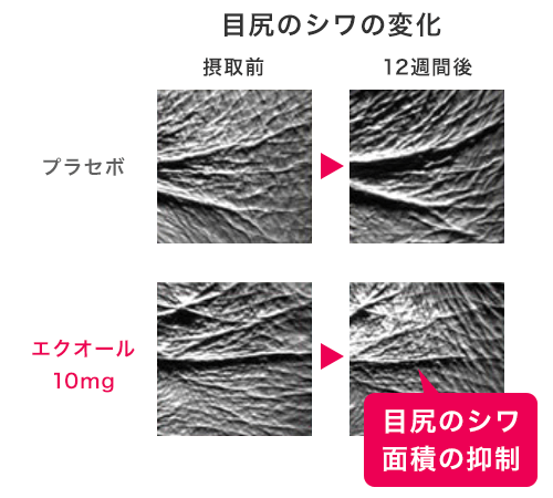 エクオール摂取による目じりのシワの改善