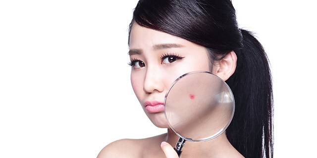 大人ニキビで悩んでいる人必見！こんな生活習慣がニキビを作っている！