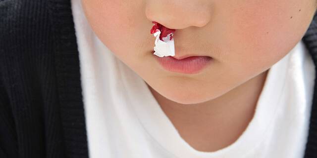 鼻血 止め 方 子供 鼻血が止まらない9つの原因【正しい止め方も】大量に出るのは病気？